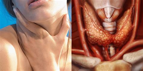 6 Common Thyroid Disorders And Their Causes | SELF