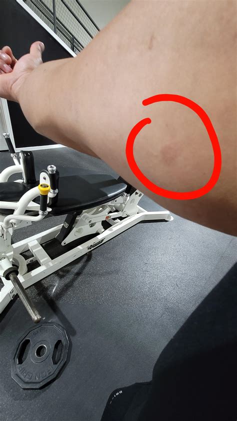 Small red dry red patches. Any idea what it might be? : r/medical_advice