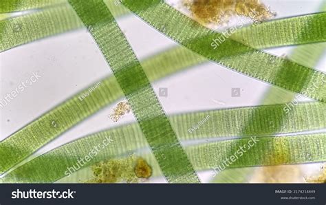 732 Cyanobacteria Under Microscope Images, Stock Photos & Vectors ...