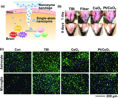 Application Of Single Atom Nanozyme In Noninvasive Treatment Of Brain Download Scientific