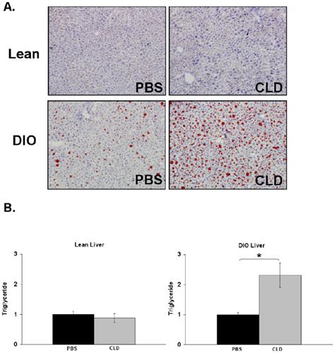 Kupffer Cell Ablation In Dio Mice Is Associated With Altered Hepatic