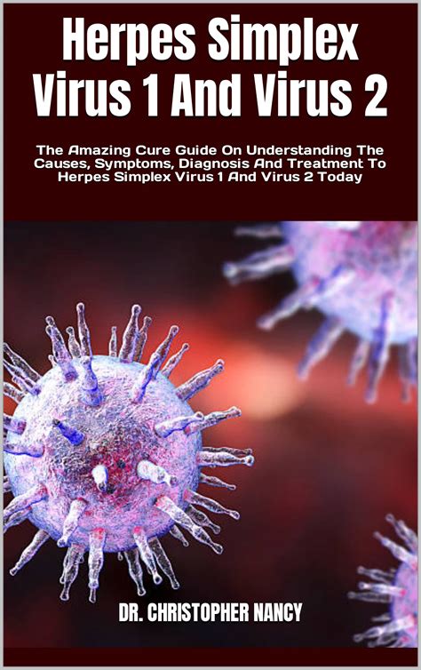 Herpes Simplex 1 Treatment
