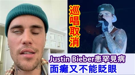 Justin Bieber患罕见病致面瘫 无奈取消巡唱向fans道歉 星岛日报