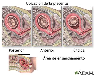 Medlineplus Enciclopedia M Dica Muestra De Vellosidad Cori Nica