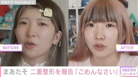 人気YouTuberまあたそ二重整形を涙ながらに報告しビフォーアフター公開本当にごめんなさい 芸能 ABEMA TIMES