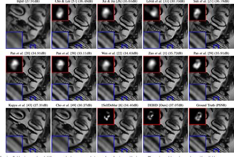 Pdf Self Supervised Blind Image Deconvolution Via Deep Generative