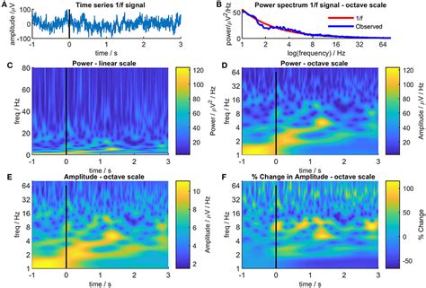 Frontiers How Conventional Visual Representations Of Time Frequency