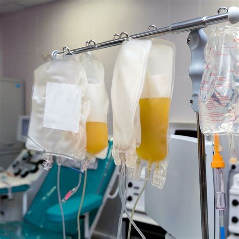 Apheresis What You Need To Know