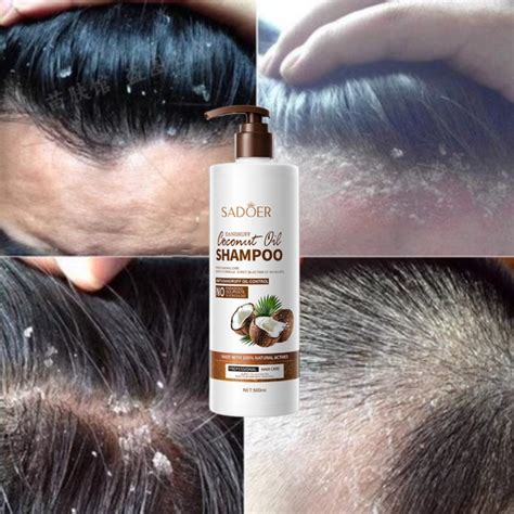 Coconut Hair Shampoo Anti Dandruff Shampoo Syampu Rambut Ubat Kelemumur