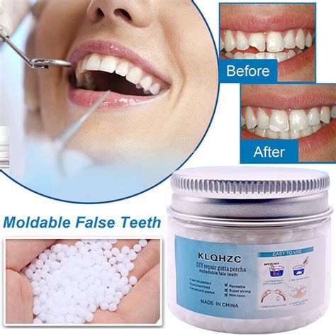 Temporary Tooth Repair Kit 50g Artificial Temporary Tooth Teeth Teeth