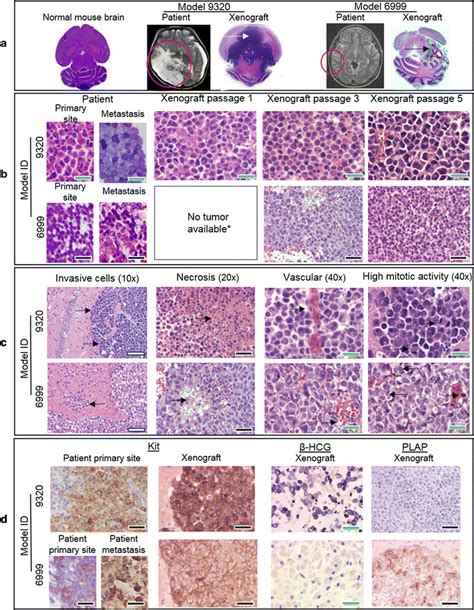 Pdox Model Histopathology Hande Whole Brain Imaging Of Normal Mouse And