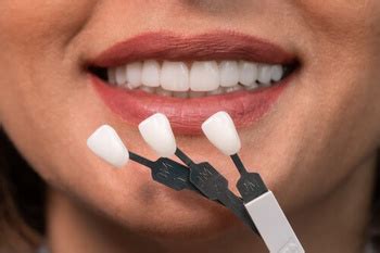 Veneers Vs Dentures Key Differences Best Choice