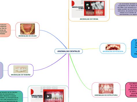 Anomalias Dentales Mind Map