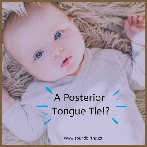 A Posterior Tongue Tie?!