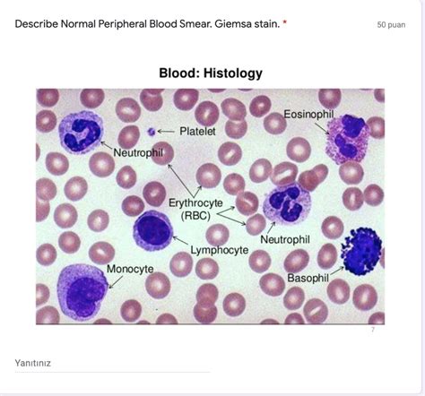 Solved Describe Normal Peripheral Blood Smear. Giemsa stain. | Chegg.com