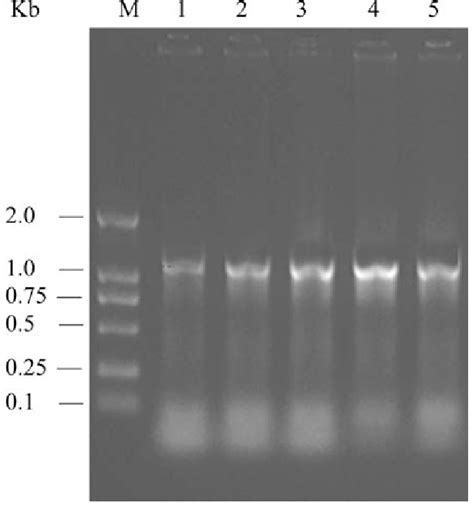 Effect Of DNA Amount On Amplification Reaction Lane M DL2000 DNA