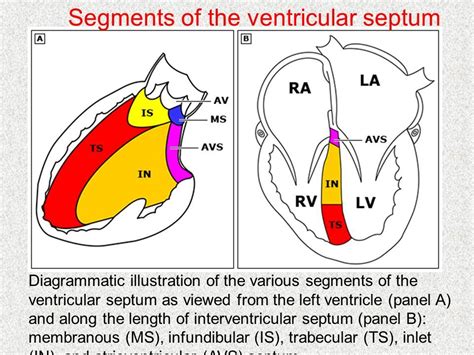 Infundibular Septum | Hot Sex Picture