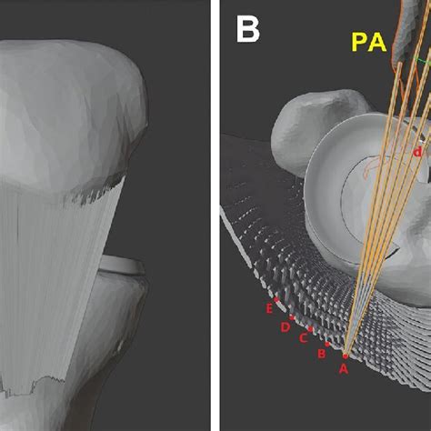 Measurements Were Performed Using Three Dimensional Computed Tomography Download Scientific