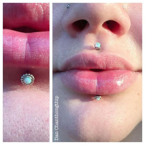 Lip Piercing Bump Inside Mouth