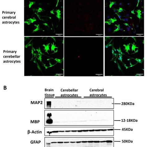 Investigation Of Primary Cortical Astrocytes Cx And Cerebellar