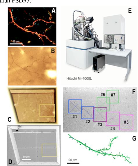 Pdf Correlative Light And Electron Microscopy Of Brain Tissue Using