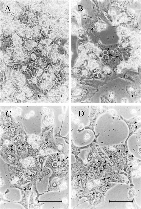 Cytopathic Effect Of Human Cytomegalovirus HCMV In Cultured Human