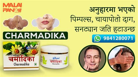 Introducing Charmadika Cream Your Solution To Melasma Black Spot