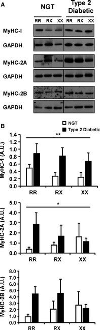 Protein Abundance Of The Human Myosin Heavy Chain Isoforms Abundance