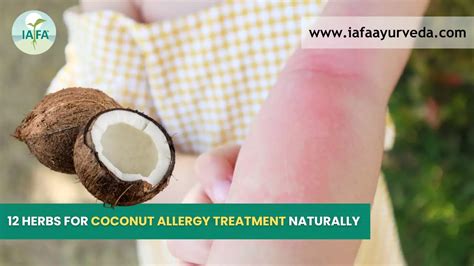 12 Herbs for Coconut Allergy Treatment Naturally - IAFA Ayurveda India