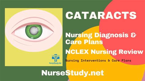 Cataracts Nursing Diagnosis & Care Plan - NurseStudy.Net