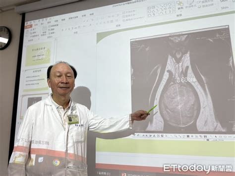 男大生蛋蛋變大不敢說！半年腫像鵝蛋 就醫竟是睪丸癌 Ettoday生活新聞 Ettoday新聞雲