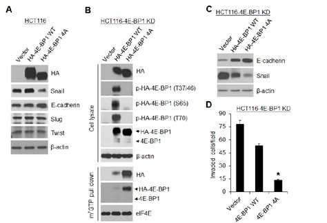 A Dominant Active 4e Bp1 Mutant Profoundly Inhibits Snail Expression Download Scientific