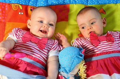 Irish Twins Born 87 Days Apart Set World Record