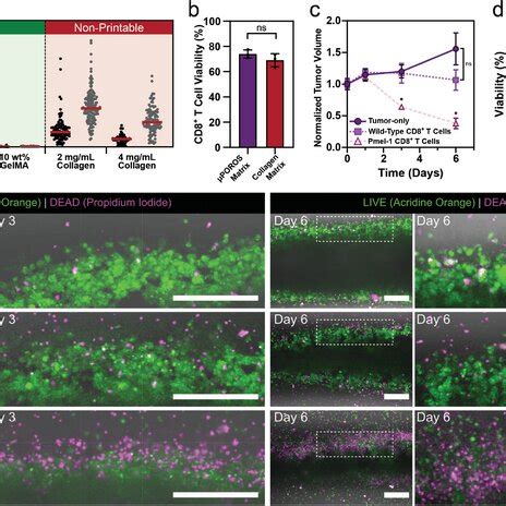 3D melanoma tumor model printed within µPOROS collagen matrix a A