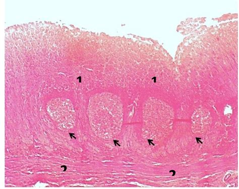 Histological Section Of The Posterior Part Of Abomasum Pylorus Shows