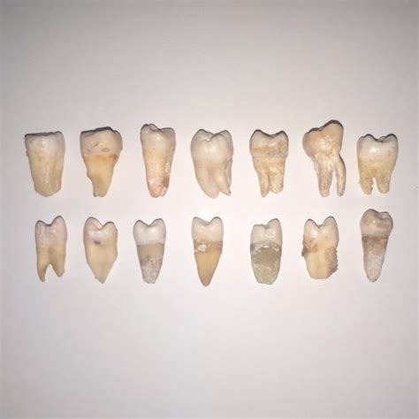 Jual Gigi Asli Posterior Untuk Praktikum Gigi Premolar Gigi Molar