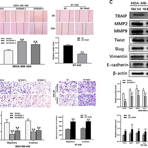 Traip Knockdown Inhibits Tnbc Cell Lines Migration And Invasion By