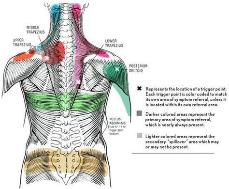 Massage Trigger Points Trigger Points Trigger Point Massage Referred Pain