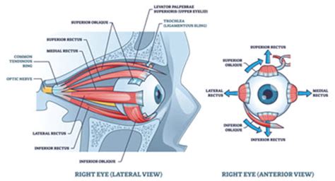 See 3 Ways To Boost Strabismus Claim Success Procedure Focus