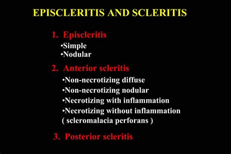 PPT - EPISCLERITIS AND SCLERITIS PowerPoint Presentation, free download