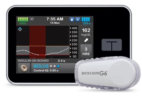 Tandem Connecting The Dexcom G6 Cgm Transmitter To The Tslim X2