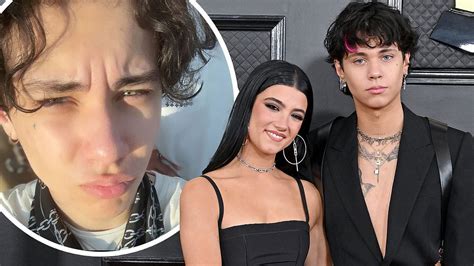 Travis Barkers Son Landon Drops Breakup Song Over You After Charli D