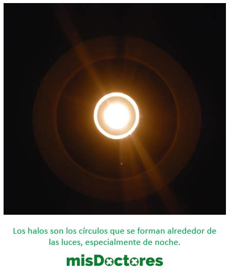 Halos Alrededor De Las Luces ¿es Normal