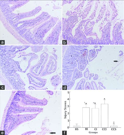 Histologic Changes Of Intestinal Mucosa And Injury Score Ae He