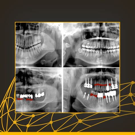 Radiologia Odontológica RadioCenter Curitiba