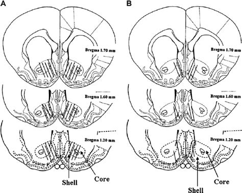 Representative Locations Of Microdialysis Probe Placements In The Nacc