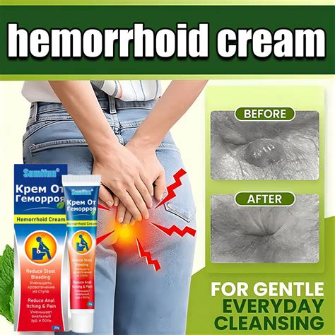 Hemorrhoid Cream Anti Hemorrhoids Hemorrhoids Removal Burning