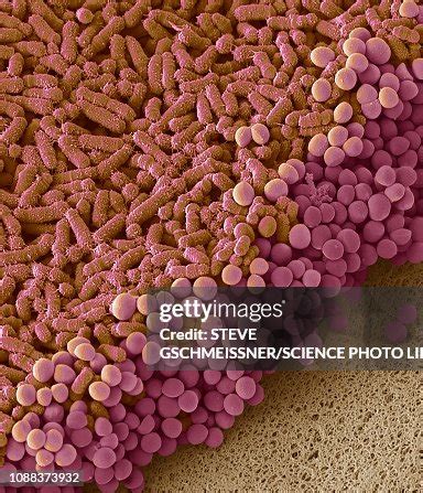 Faecal Bacteria Sem High-Res Stock Photo - Getty Images