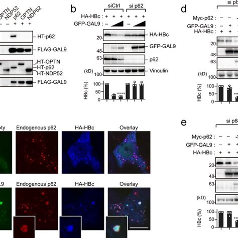 Gal Degrades Hbc Via P Mediated Selective Autophagy A Gal Interacts