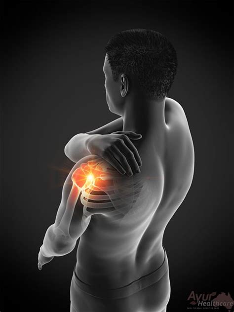 Ayurvedic Treatment For Frozen Shoulder Ayur Healthcare